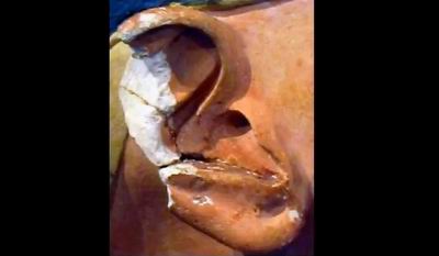 скульптор-фальсификатор пытался сымитировать трещину в ушной раковине