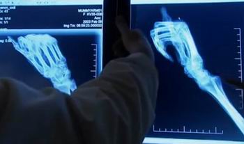 Рентген этой рука