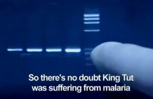 Тутанхамон умер от малярии?