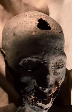Пробитая голова у мумии KV 35 YL