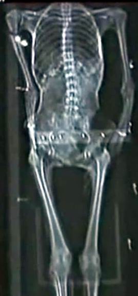 Рентгеновский снимок мумии KV 35 YL